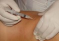 Mesoterapia